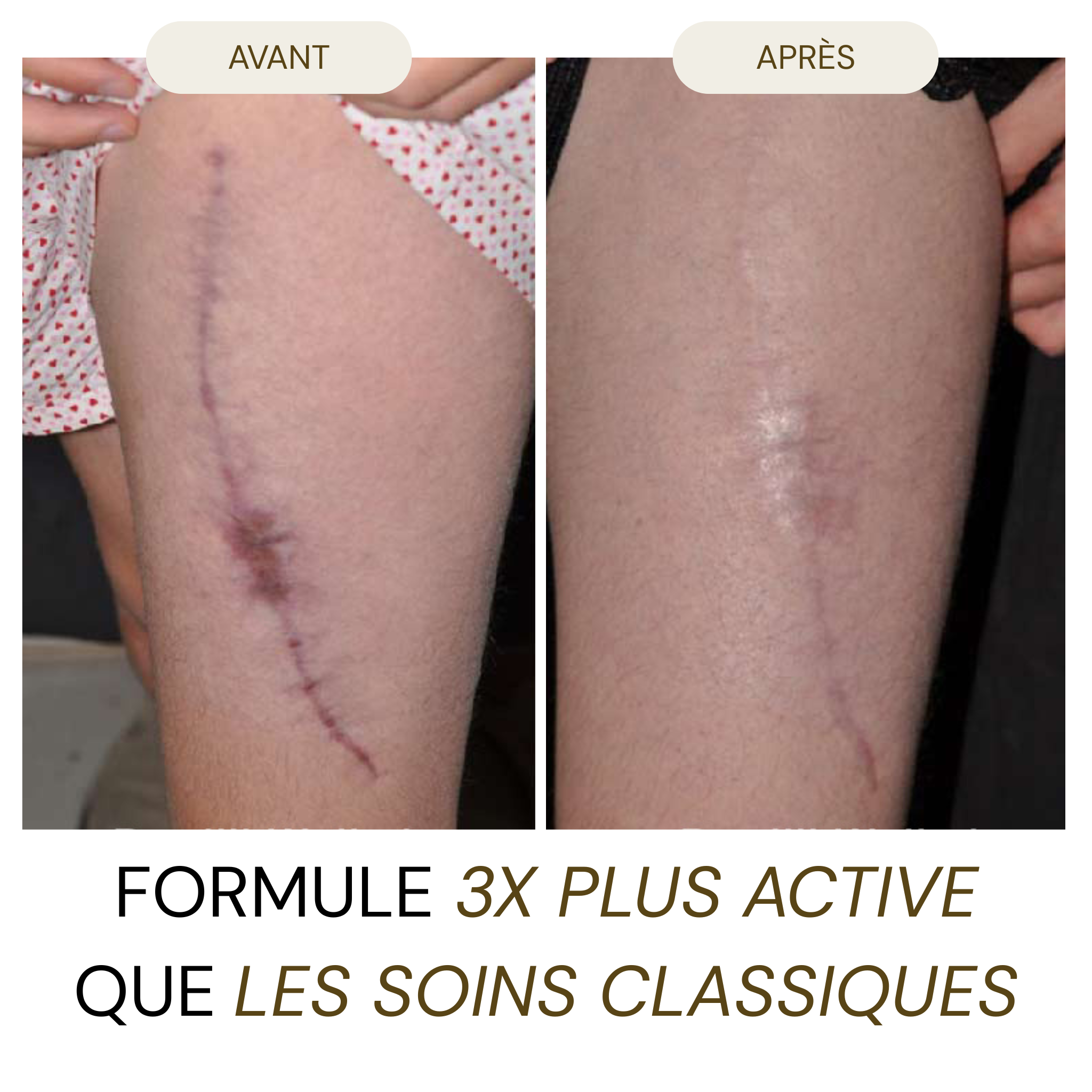 UnicYou - Stick DermaRepair