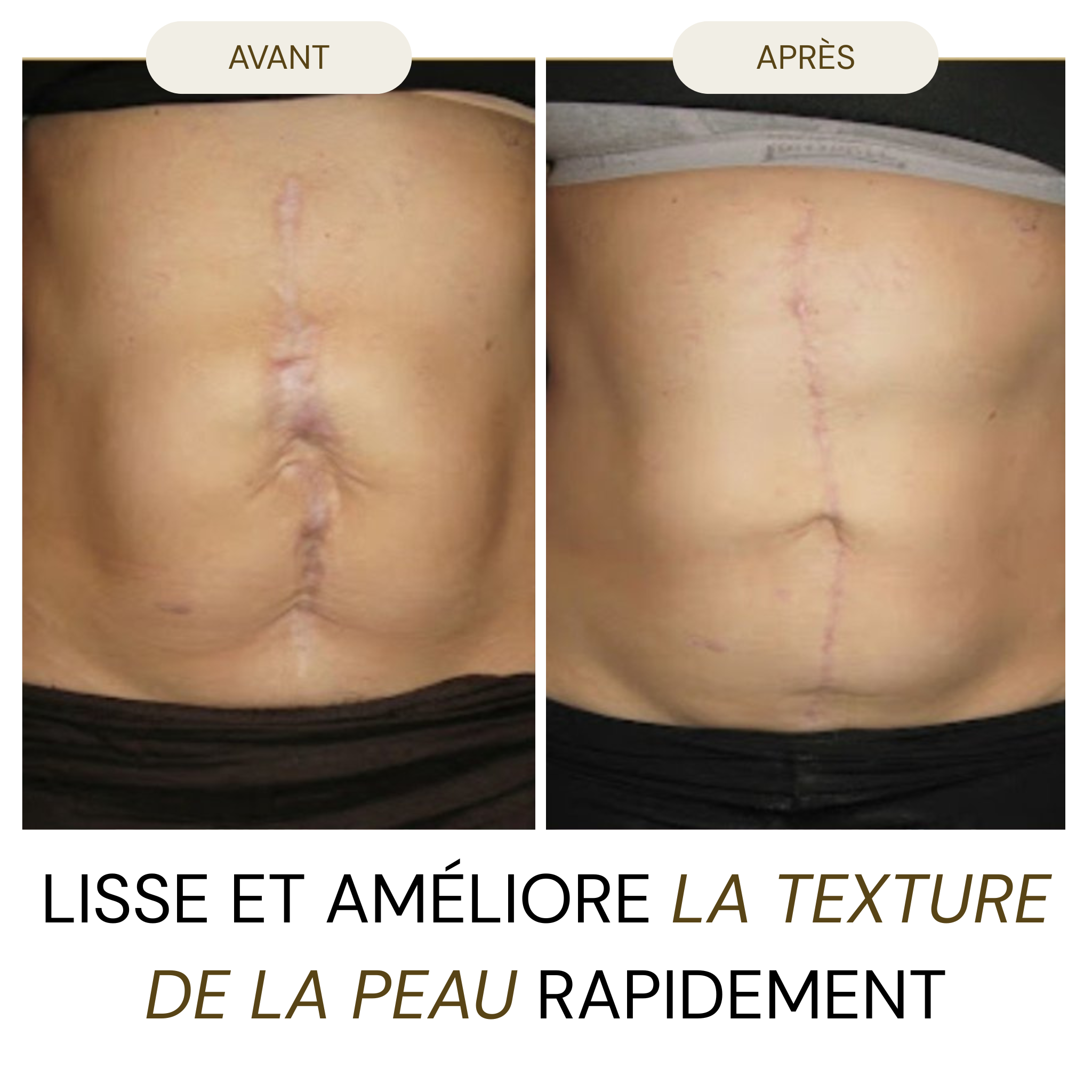 UnicYou - Stick DermaRepair